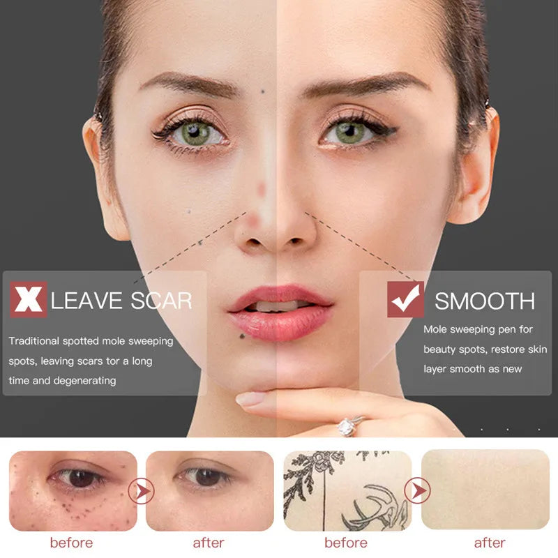 Skin Tag & Mole Eraser